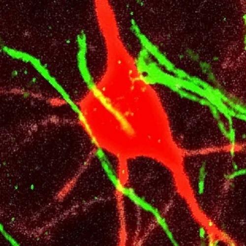 Descoberto estranho novo tipo de célula cerebral