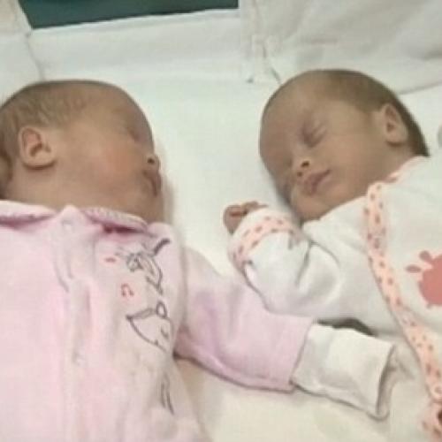 Caso raro: mulher dá luz a Gêmeos em datas diferentes.
