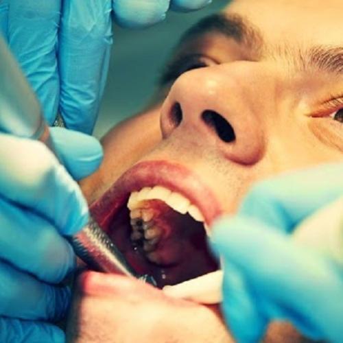 Nova tecnologia faz com que dentes estragados se reparem