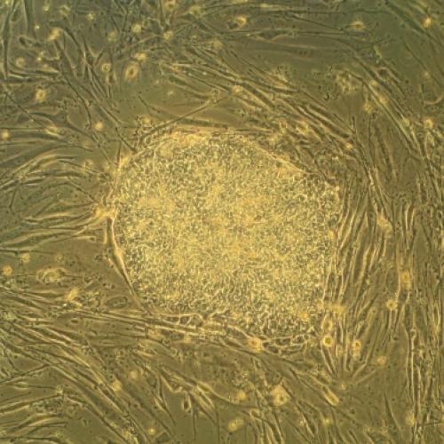 Cientistas criaram o primeiro músculo esquelético de células tronco.