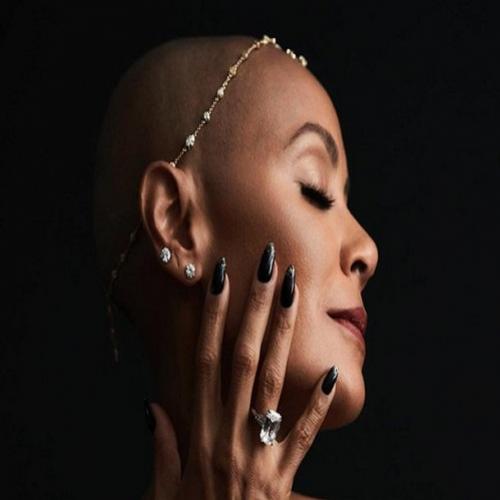 Alopecia: A condição que afeta Jada Pinkett Smith, espota de Will Smit