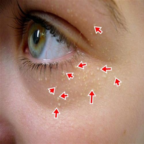 Sabe o que podem ser esses pontos brancos na cara?