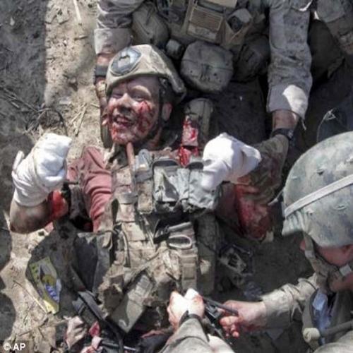 Este soldado sorriu a vida inteira. Mesmo quando seus membros foram ar