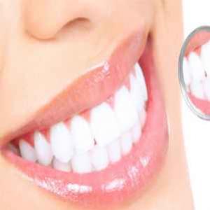 Dicas para manter os dentes mais brancos de forma natural