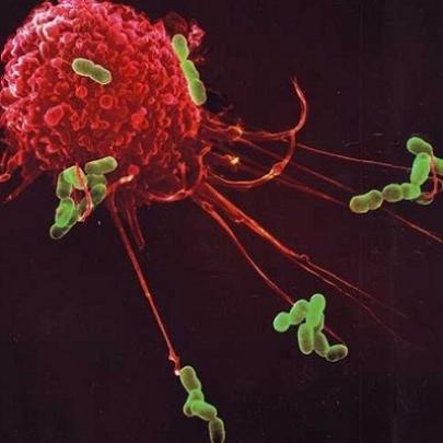 Uma guerra interna: O nosso sistema imunológico