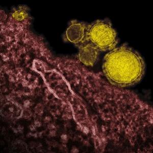 Novo Vírus MERS: Metade dos Infectados Morrem