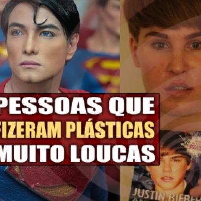 As pessoas que fizeram cirurgias plásticas mais bizarras do mundo