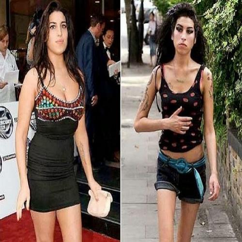 10 fotos do antes e depois de usuários de drogas.