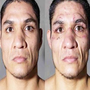 O antes e depois de uma luta de boxe