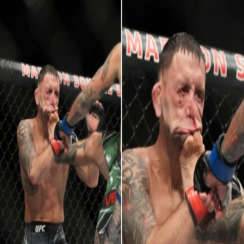 UFC: Boxer mudou irreconhecível após levar um chute no rosto