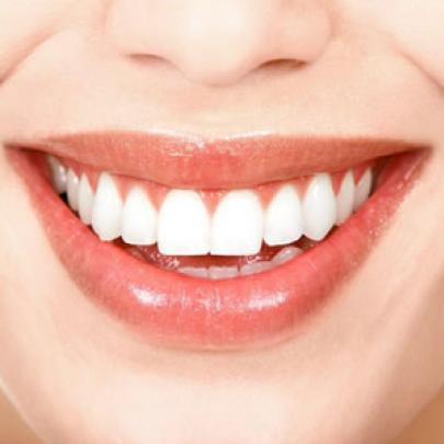 Técnica pode evitar tratamento restaurador nos dentes