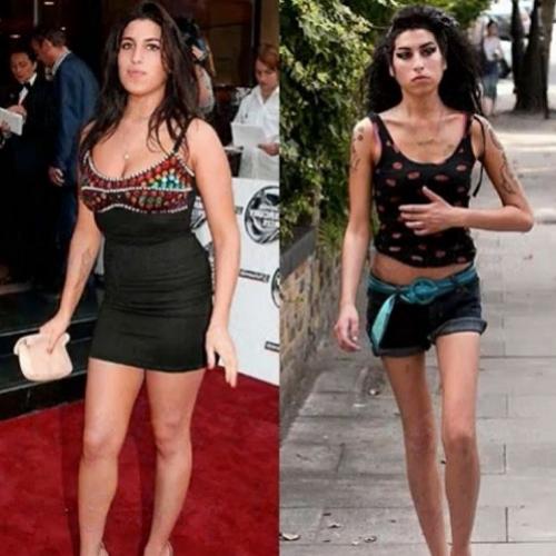 11 fotos do antes e depois de usuários de drogas.