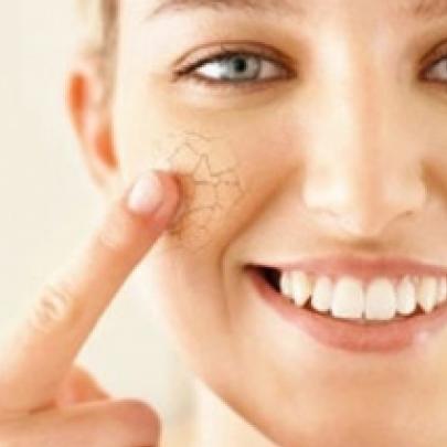 Como identificar e tratar pele seca