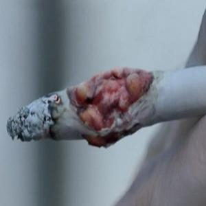 Propaganda mostra tumor crescendo dentro de cigarro!