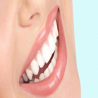 Dicas para deixar seu sorriso mais branco 