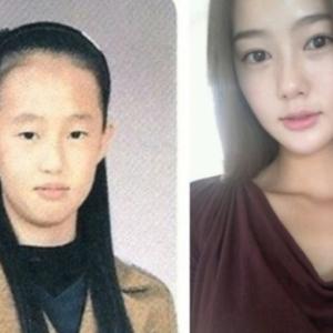 Fotos do antes e depois na cirurgia plástica coreana (30 fotos)