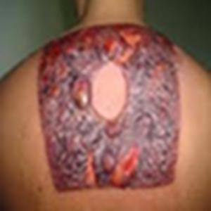 Os perigos da tatuagem de henna