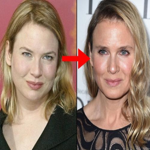 Atriz Renée Zellweger aparece irreconhecível em evento