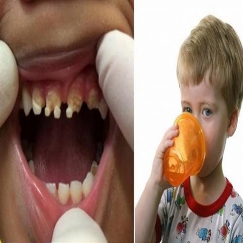 Os pais estão chocados com o que causou a deterioração maciça do dente