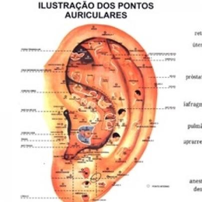 auriculoterapia - conhecendo esta tecnica.