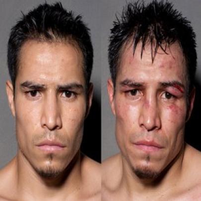 Fotos de lutadores antes e depois das lutas que vão te surpreender