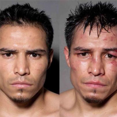 Fotos de boxeadores antes e depois da sua luta.