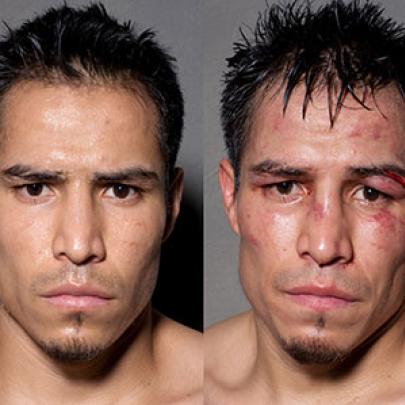 12 fotos chocantes de boxeadores antes e depois de uma luta