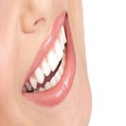 Como clarear os dentes da boca