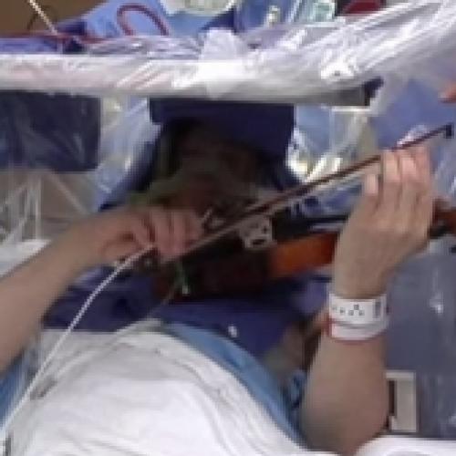 Homem toca violino para ajudar em sua cirurgia cerebral