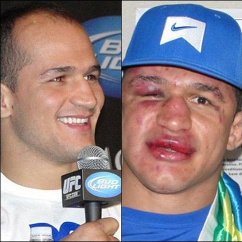 Lutadores de MMA antes e depois da luta