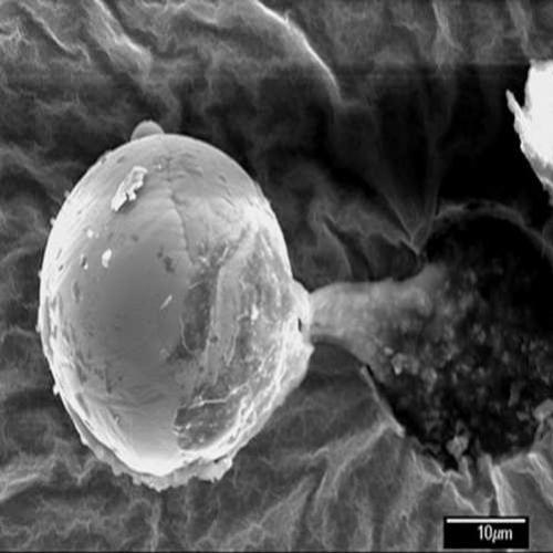 Esfera de metal vinda do espaço expele material biológico e intriga ci