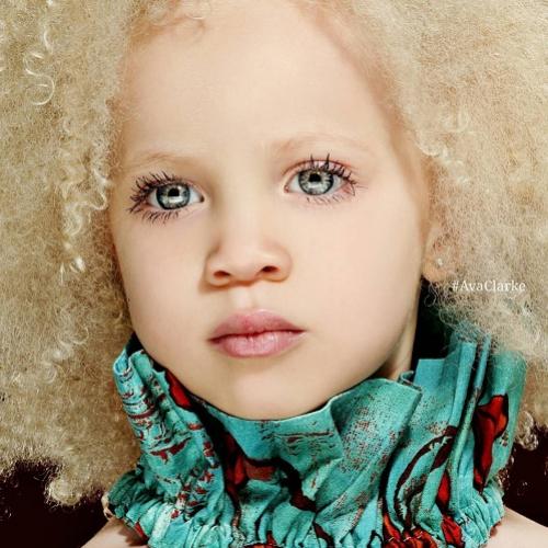 Conheça Ava Clarke, uma linda menina negra com albinismo