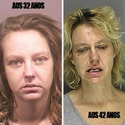 O antes e depois dos usuários de metanfetamina