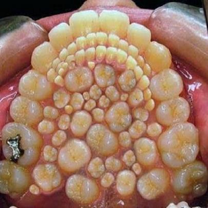 Esses dentes são reais ?