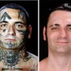 Tatuagens Racistas – Antes e Depois