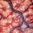 Imagem do dia: Um cérebro humano vivo em close