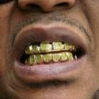 Pessoas com dentes de ouro