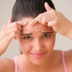5 Dicas infalíveis para se livrar da acne