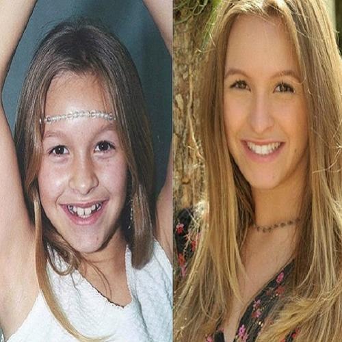 Fotos do antes e depois da Carla Diaz