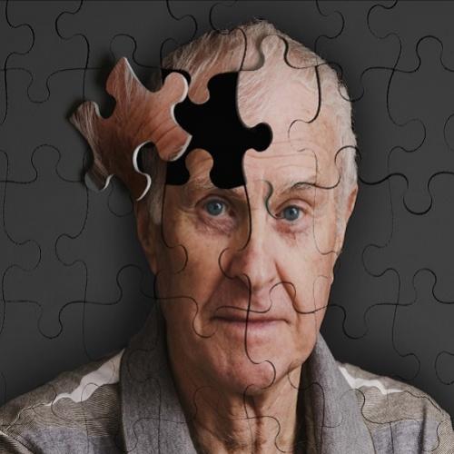Cientista constatam que Alzheimer pode ser transmitido em procedimento