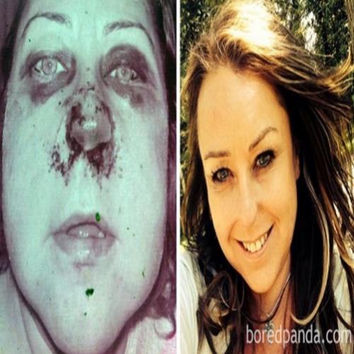 25 fotos do antes e depois de pessoas que abandonaram as drogas