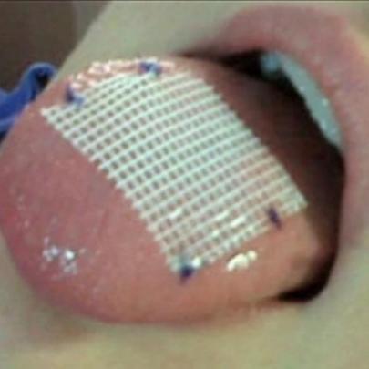 Você sabe pra que serve esta atadura na língua?