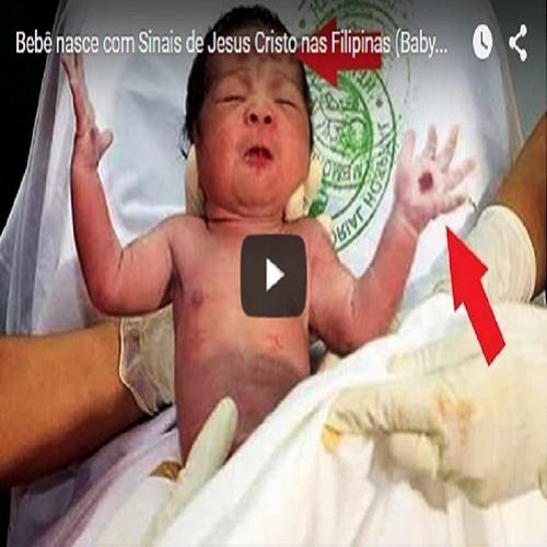 Bebê nasce com sinais de Jesus Cristo nas Filipinas