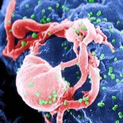 Pesquisadores descobrem método de levar vírus HIV à autodestruição