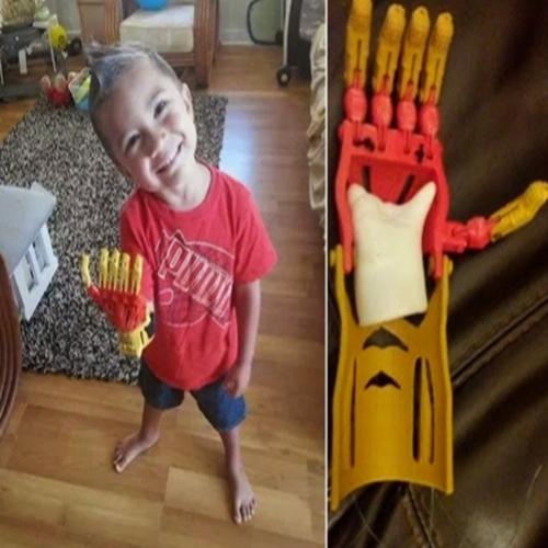 Garoto de 3 anos obtém mão protética do Homem de Ferro impressa em 3D