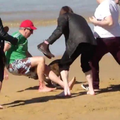 Cão ataca e morde pessoas na praia