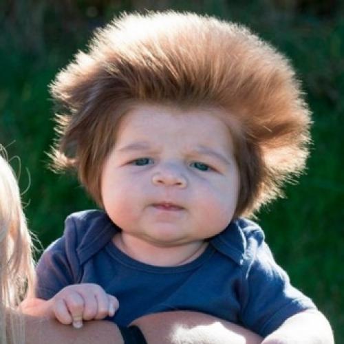 Conheça Cox, o bebê mais cabeludo do mundo