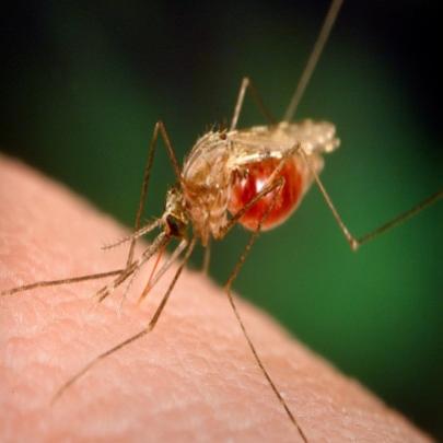 Picada de mosquito - como se livrar da coceira