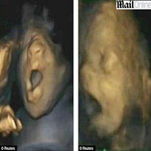 Imagem impressionante mostra bebê bocejando no útero