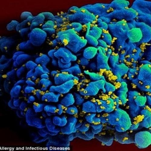 Pesquisadores descobrem uma vacina para o HIV